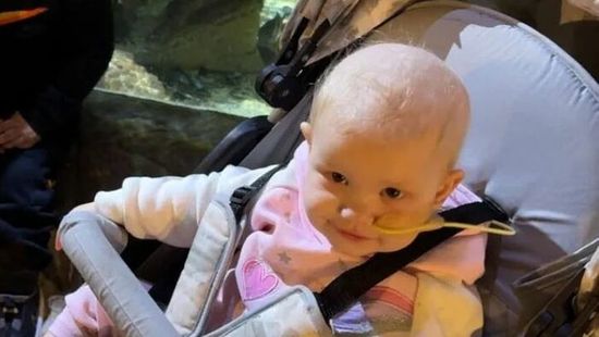 A bölcsődéből riasztották a szülőket: csomó jelent meg a baba nyakán, heteket adtak neki